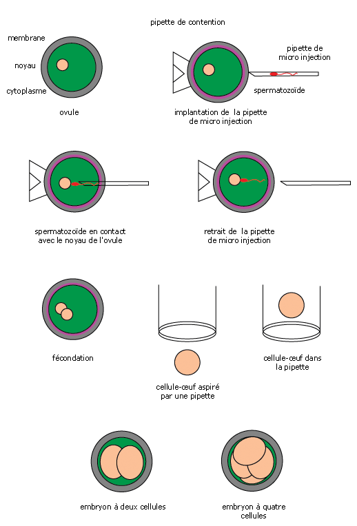 La fécondation in vitro - myMaxicours